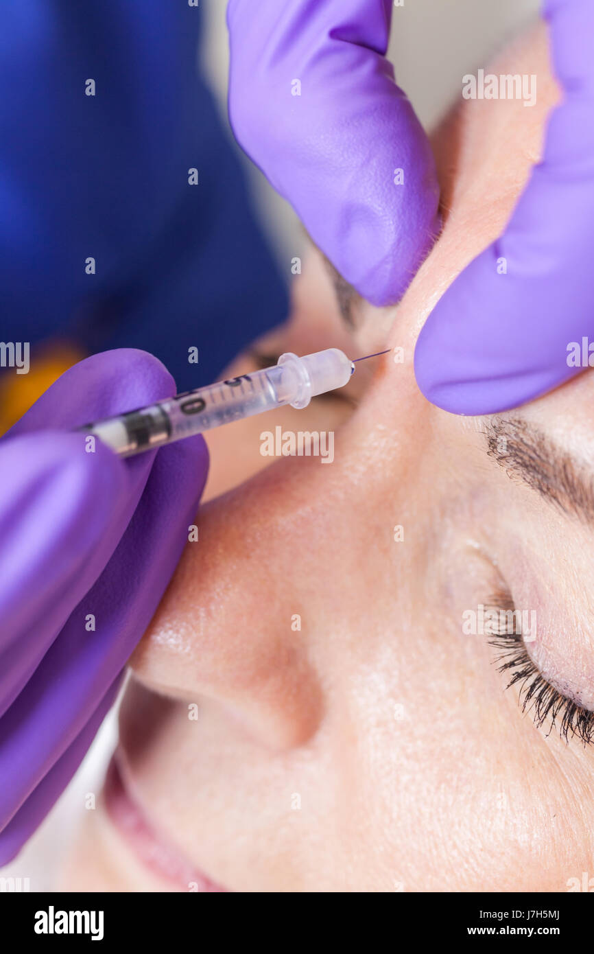 Un cosmetico chirurgo plastico medico siringa di iniezione di Botox per la testa di un senior donna femmina paziente in ospedale o in clinica Foto Stock