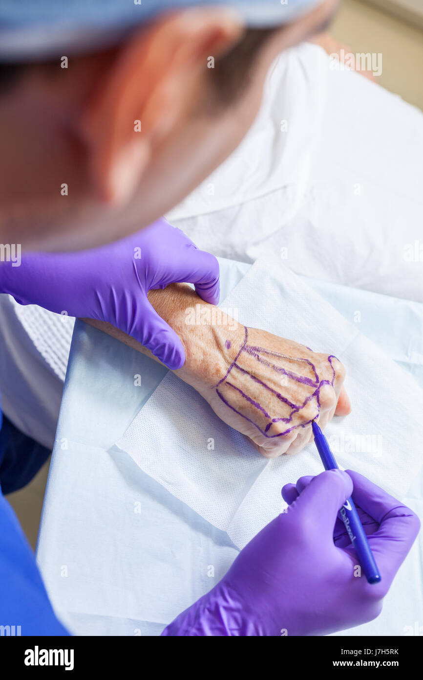 Un cosmetico chirurgo plastico medico utilizzando una penna marcatura fino alla mano di un senior donna femmina paziente in ospedale o in clinica prima di un intervento chirurgico Foto Stock