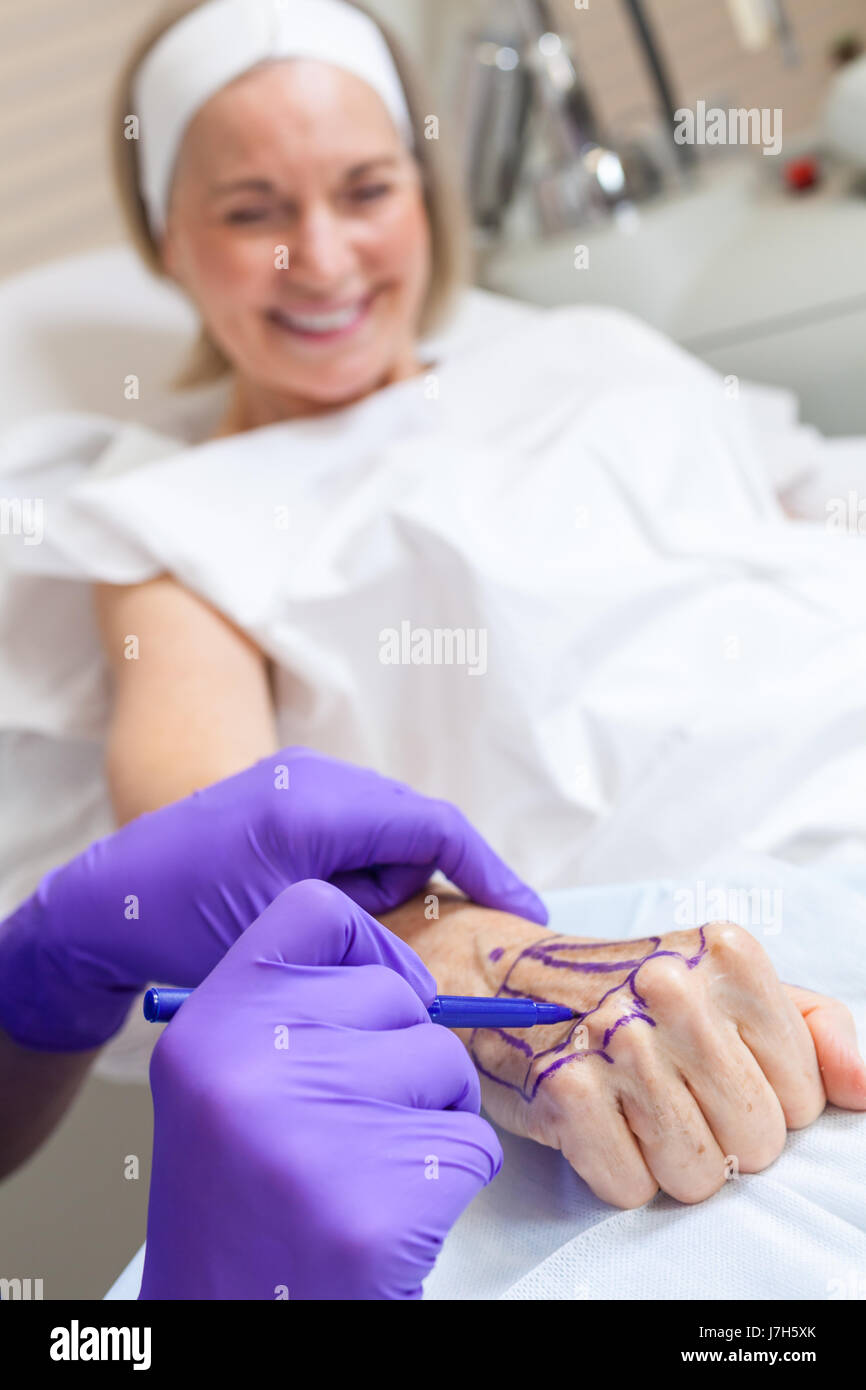 Un cosmetico chirurgo plastico medico utilizzando una penna marcatura fino alla mano di un senior donna femmina paziente in ospedale o in clinica prima di un intervento chirurgico Foto Stock