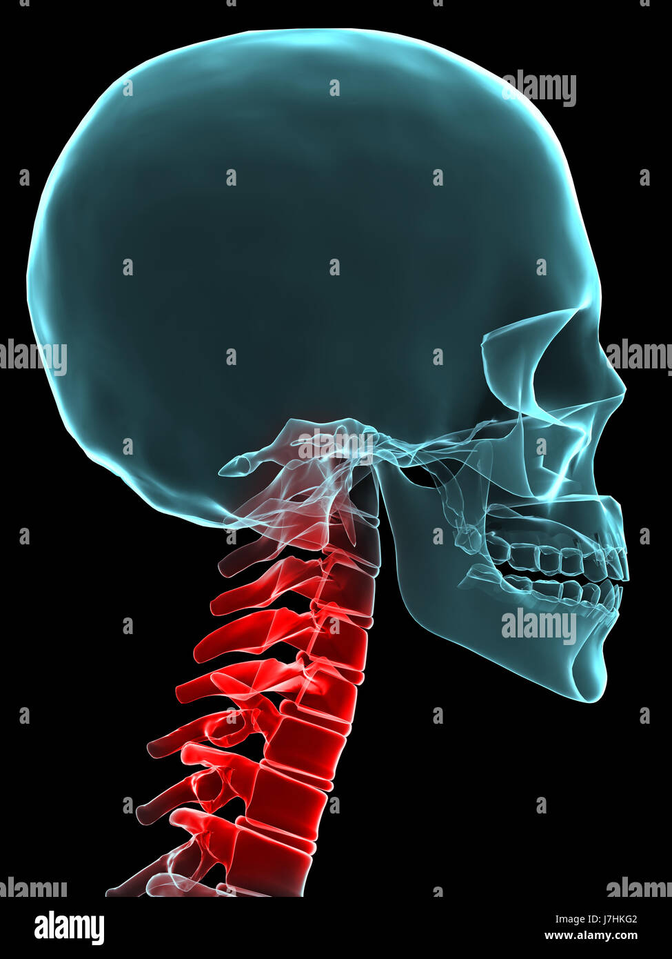 La salute umana essendo umano anatomia dello scheletro della colonna vertebrale mal di schiena, artrite osteoporosi Foto Stock