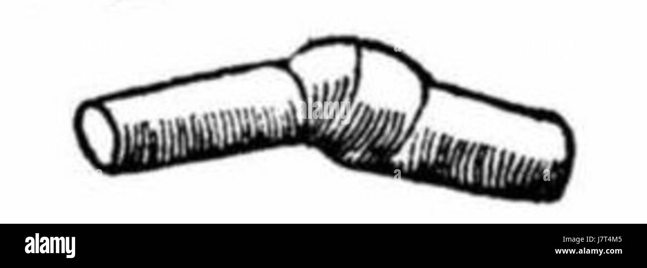 Ausschnitt Bandwurm Fisch si riferisce a una sezione di un pesce infettato da una tenia. Il termine "Ausschnitt" si traduce dal tedesco come "sezione", che indica un'attenzione particolare su una porzione di pesce. I tenia sono organismi parassiti che possono infestare vari animali, tra cui i pesci, e possono influenzare la salute umana se consumati poco cotti o preparati in modo improprio. Foto Stock