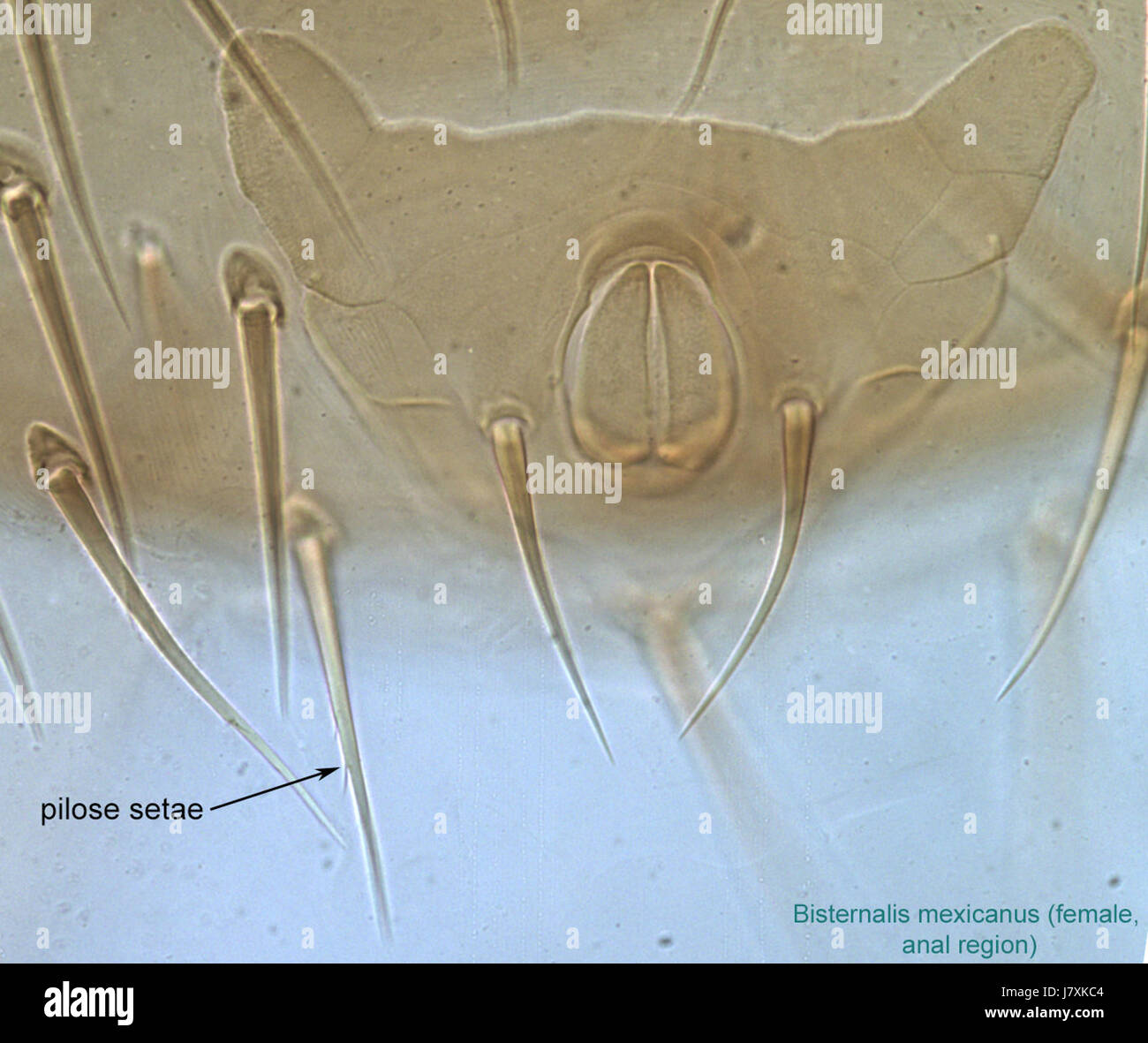 10 Bisternalis mexicanus pilose setae DIC40 Foto Stock