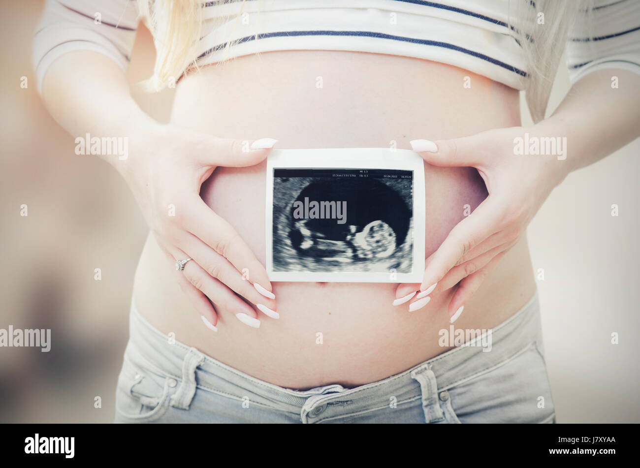 Donna incinta holding di scansione ad ultrasuoni sul suo ventre. incinta Donna ad ultrasuoni baby nuova scansione fertilità gravidanza nozione Foto Stock