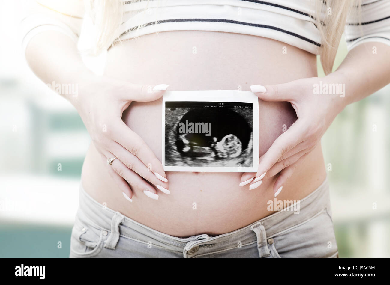 Donna incinta holding di scansione ad ultrasuoni sul suo ventre. incinta Donna ad ultrasuoni baby nuova scansione fertilità gravidanza nozione Foto Stock