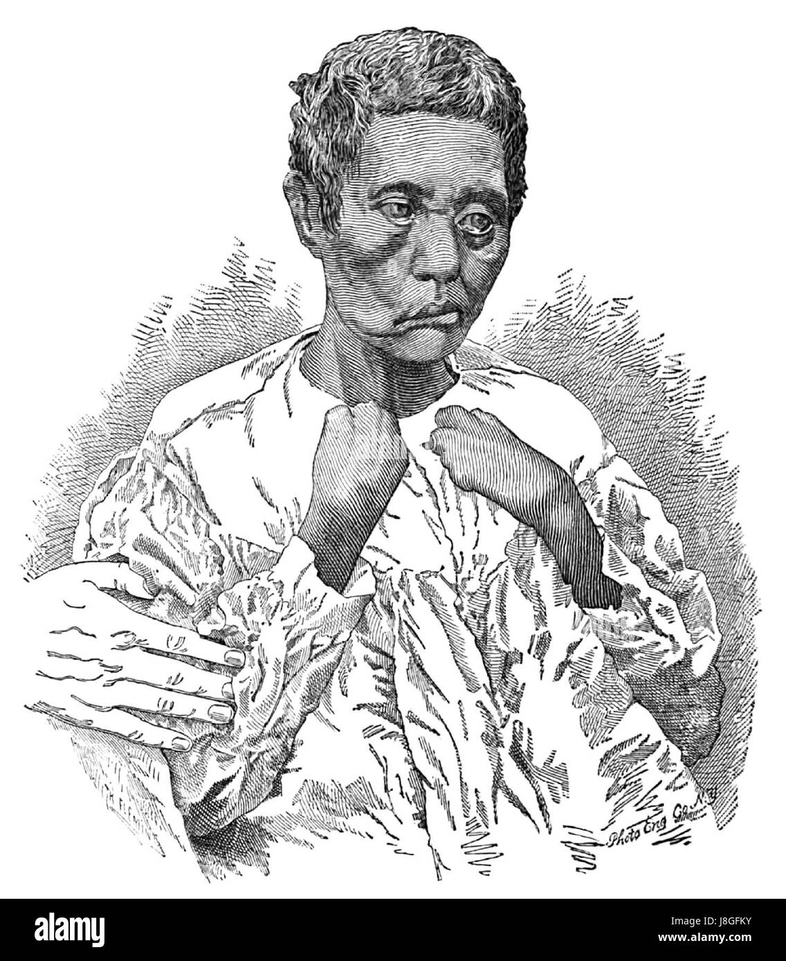 Questo titolo si riferisce a una fotografia, probabilmente tratta da un caso di studio (CASO IX) denominato Kalamau, che offre prove visive o documentazione relativa all'oggetto dello studio. Foto Stock