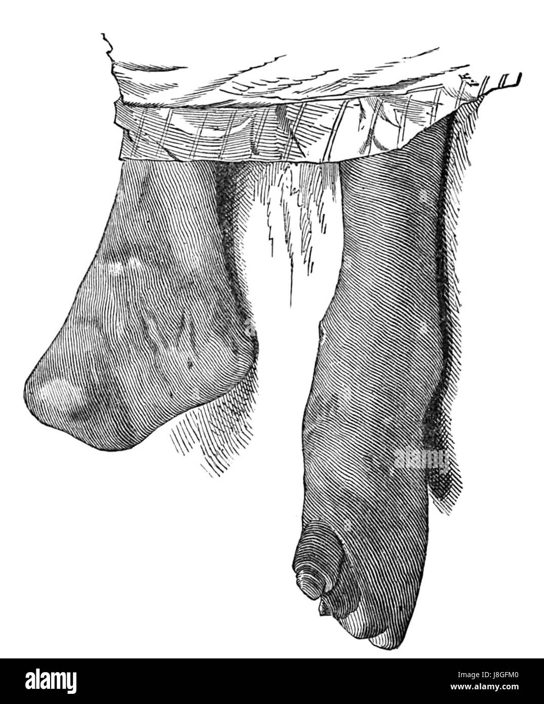 Kalamau. Caso IX. (Fotografia 6) Foto Stock