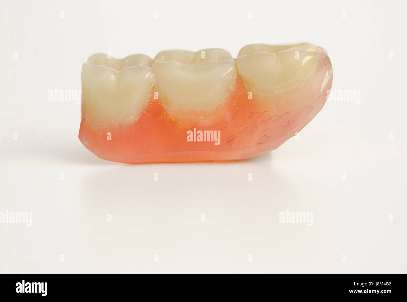 Tre denti protesici isolati su sfondo bianco Foto Stock