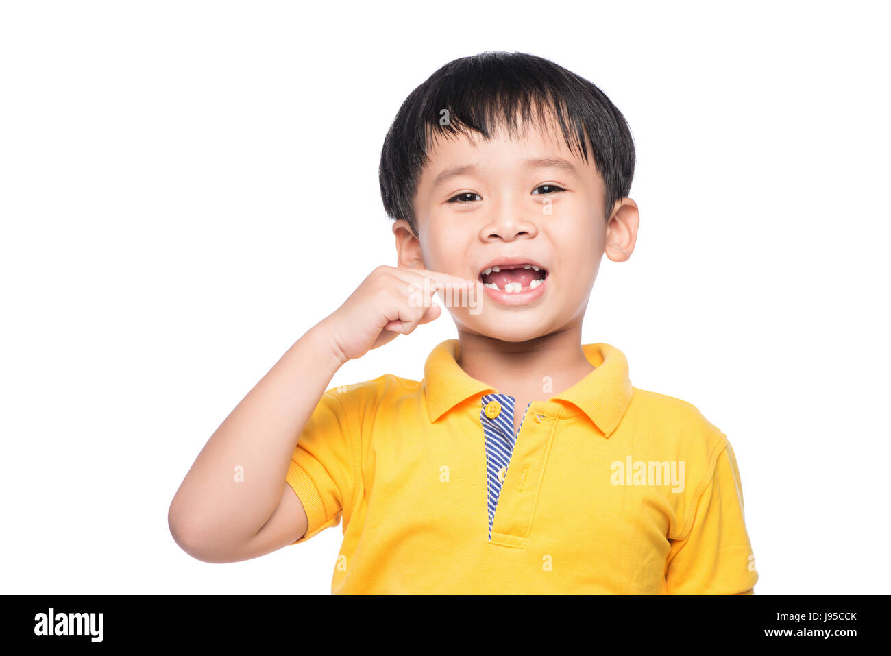 Perso il latte dente ragazzo asiatico, vista ravvicinata. Foto Stock