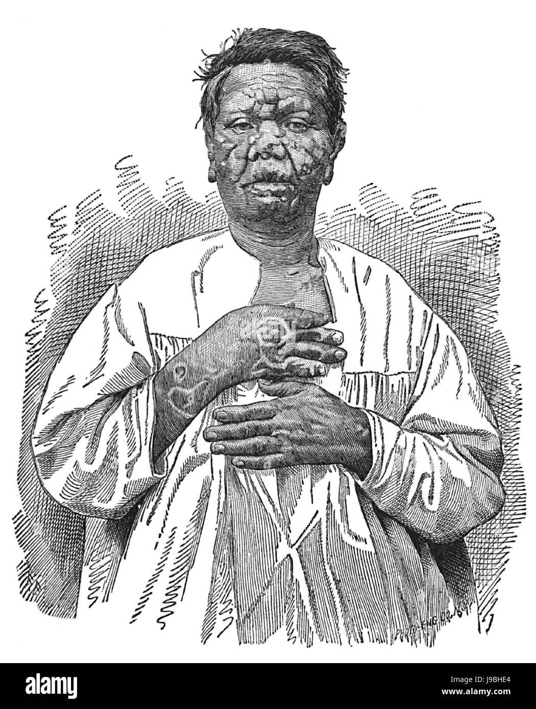 Pilaui o Pilani. Caso VI. (Fotografia 2) Foto Stock