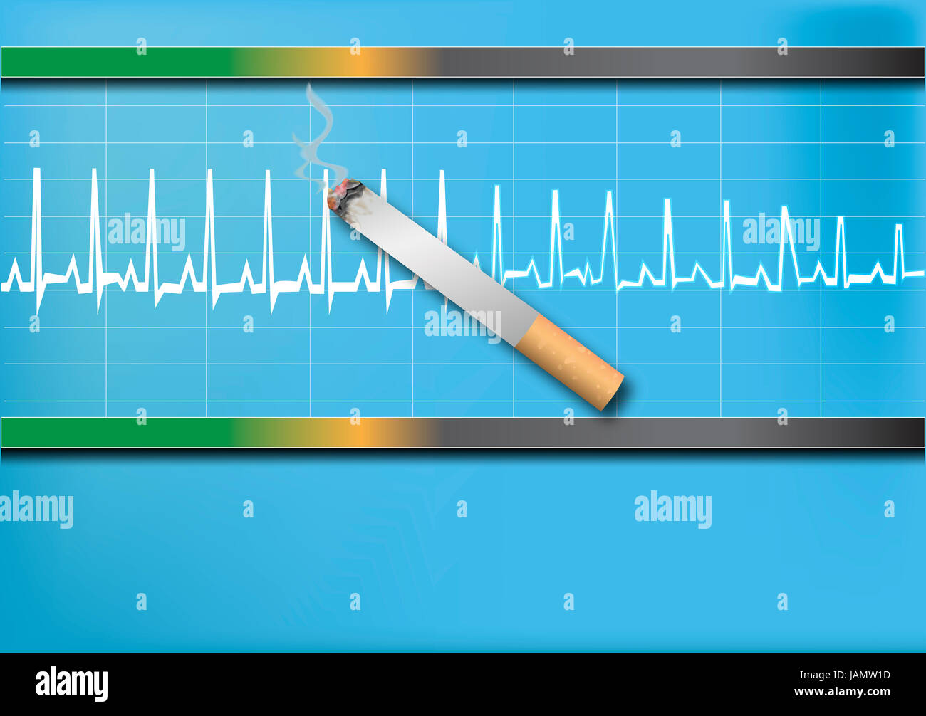 Elettrocardiogramma ecg Foto Stock