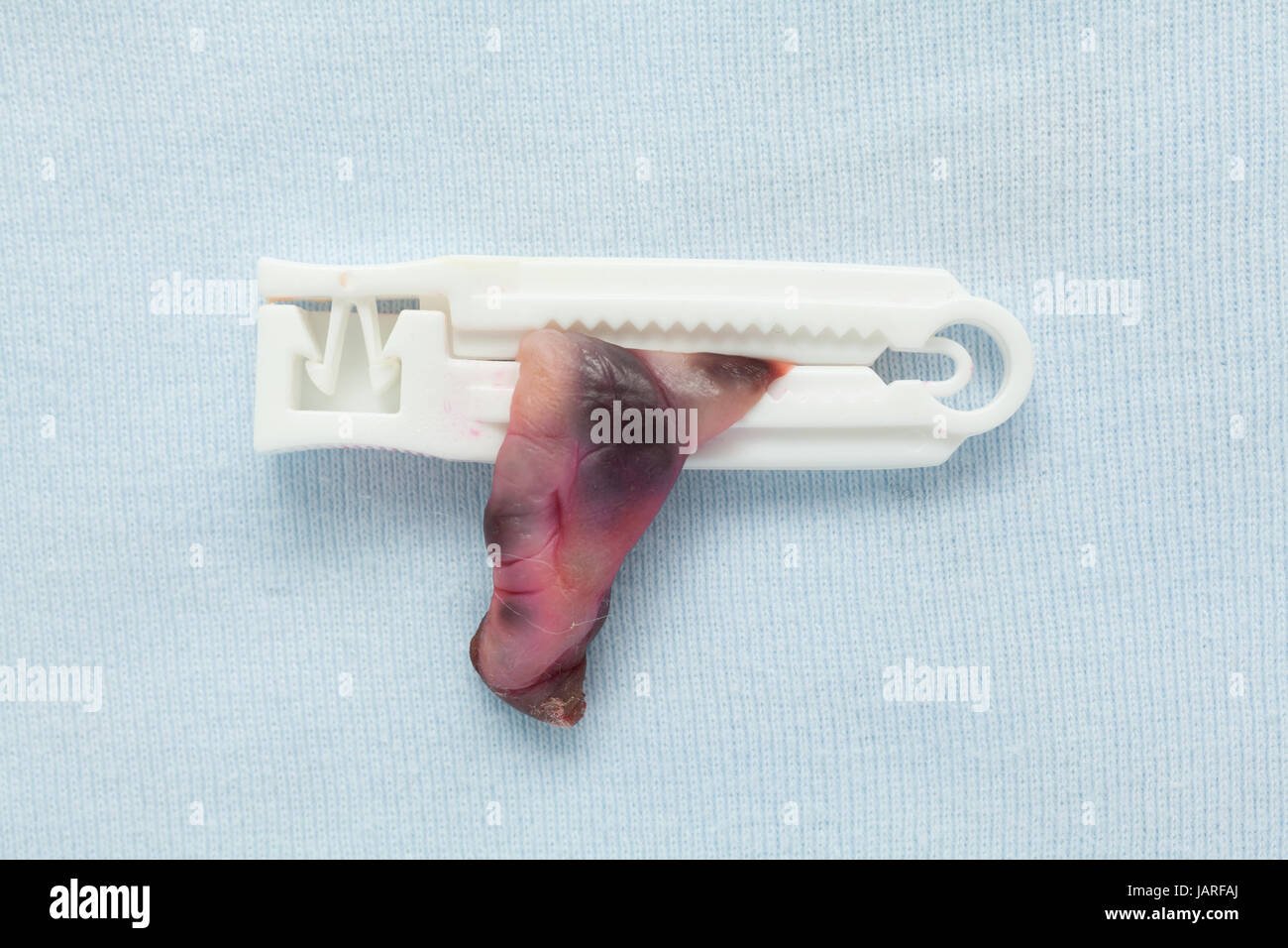 Cordone Ombelicale con la fascetta in plastica su un soffice coltre Foto Stock