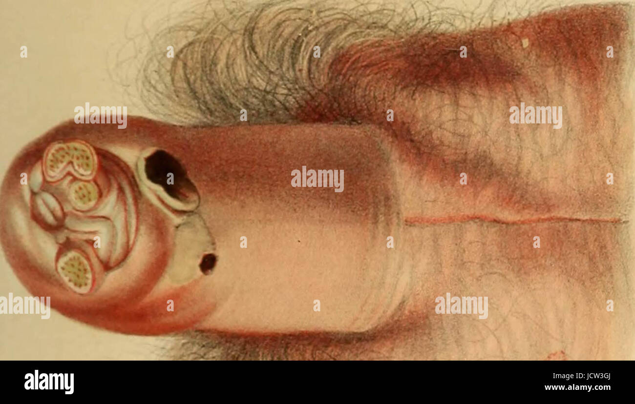 'A completare il lavoro pratico su la natura e il trattamento di malattie veneree e altre affezioni dell'apparato uro-organi del maschio e femmina .." (1848) Foto Stock