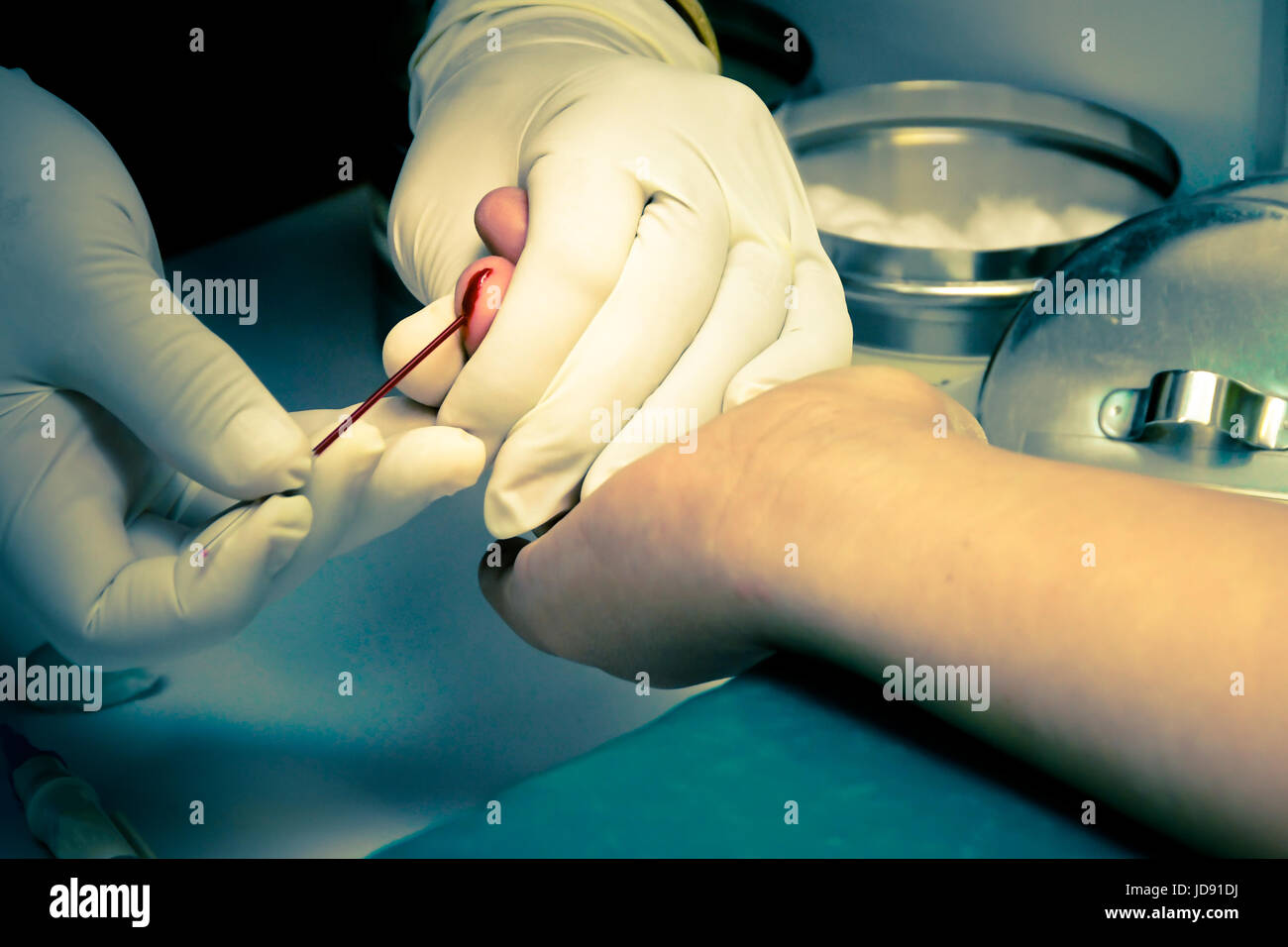 La puntura sul dito test del sangue Foto Stock