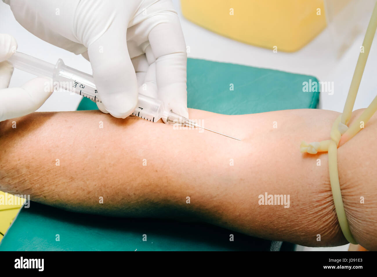 Medico o infermiere le mani in medical guanti blu mediante siringa con ago disegno campione di sangue dal braccio del paziente in ospedale. Scienziato get di prelievo del sangue per emodinamica Foto Stock