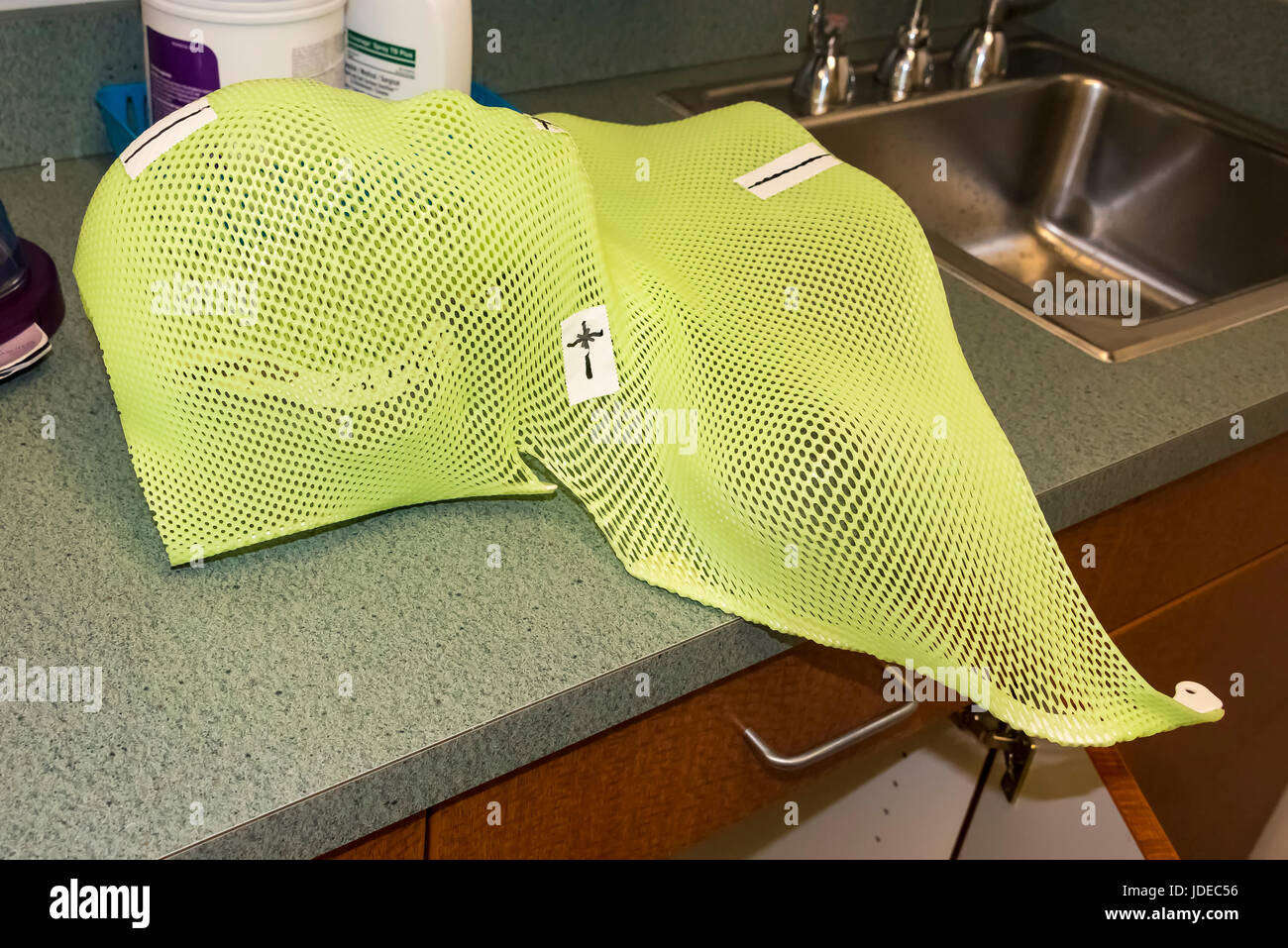 Paziente la terapia di radiazione maschera che mostra marcature laser per il bersagliamento di cellule cancerose del cervello in riparazione Foto Stock