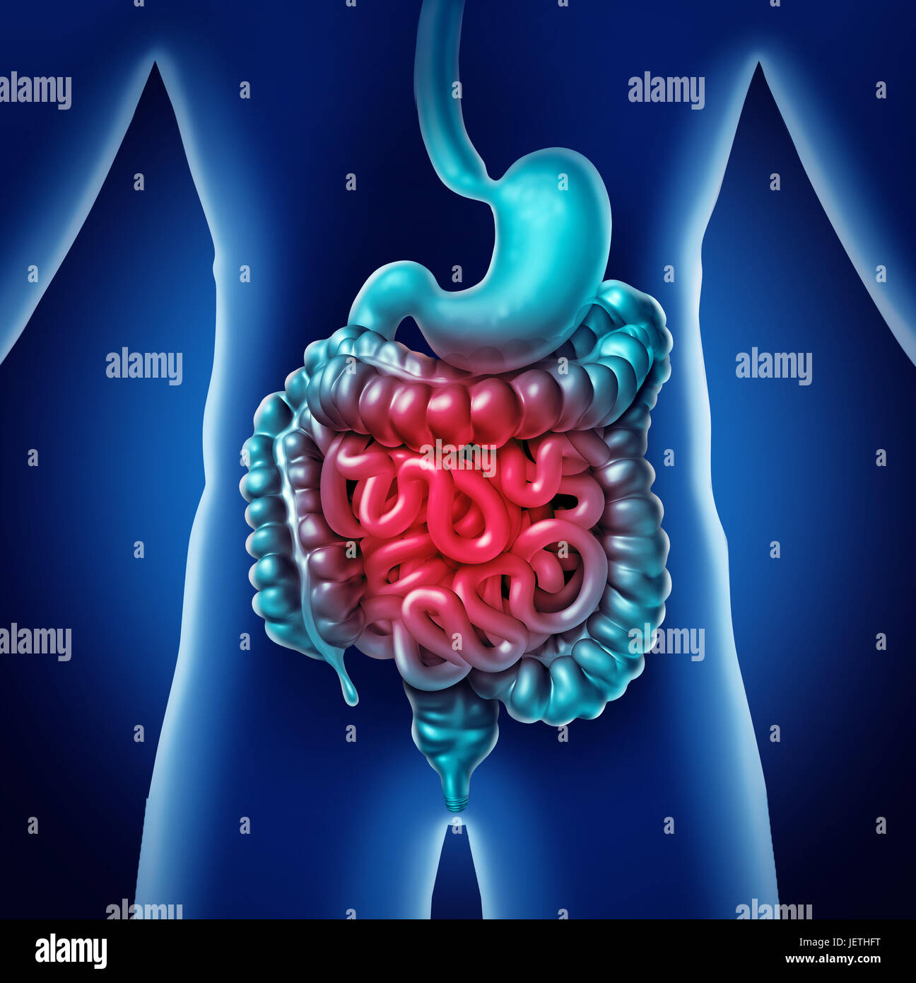 Il dolore di intestino e digestione gastrointestinale infiammazione problema come la digestione Malessere o stitichezza e infezione come a3D'illustrazione. Foto Stock