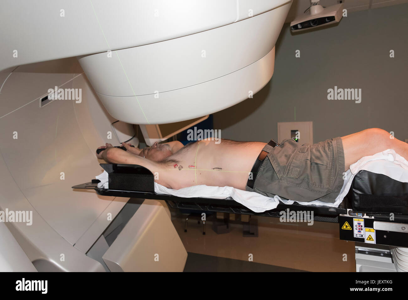 Paziente la terapia di radiazione che mostra linee di laser per il bersagliamento di cellule cancerose del cervello e della gola Foto Stock