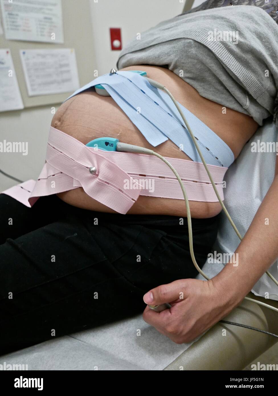 Una 41-settimana incinta Donna ispanica avente un monitor fetali non-stress test, NST. Foto Stock
