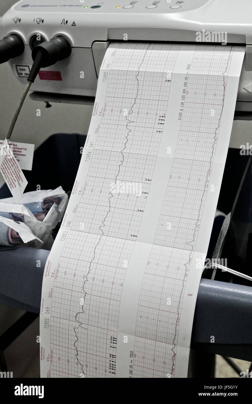 Un monitor fetali non-stress test, NST, misure un bimbo di frequenza cardiaca. Foto Stock