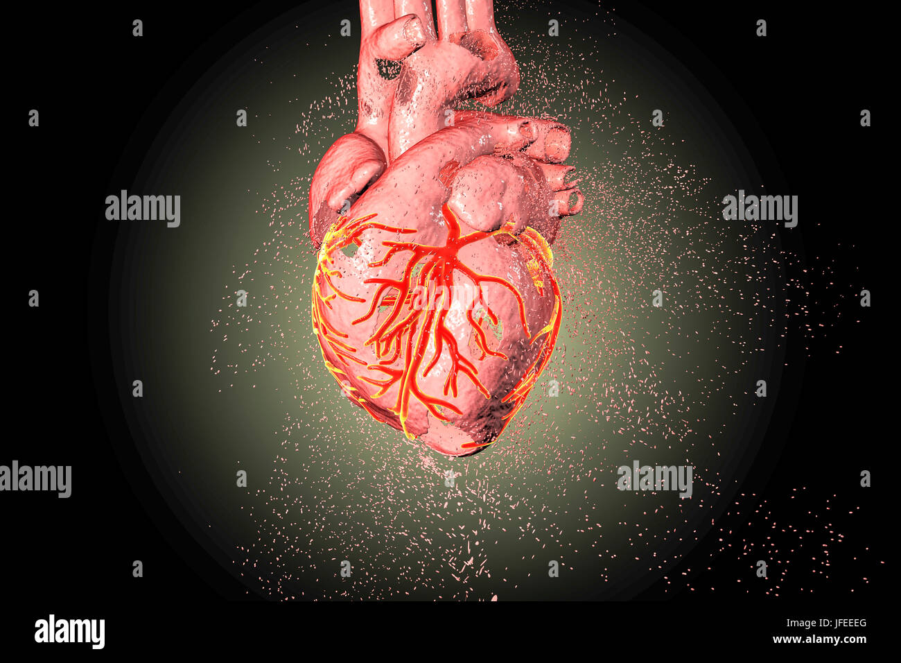 Cuore di distruzione. Concettuale illustrazione di computer che possono essere utilizzati per illustrare le malattie di cuore. Foto Stock