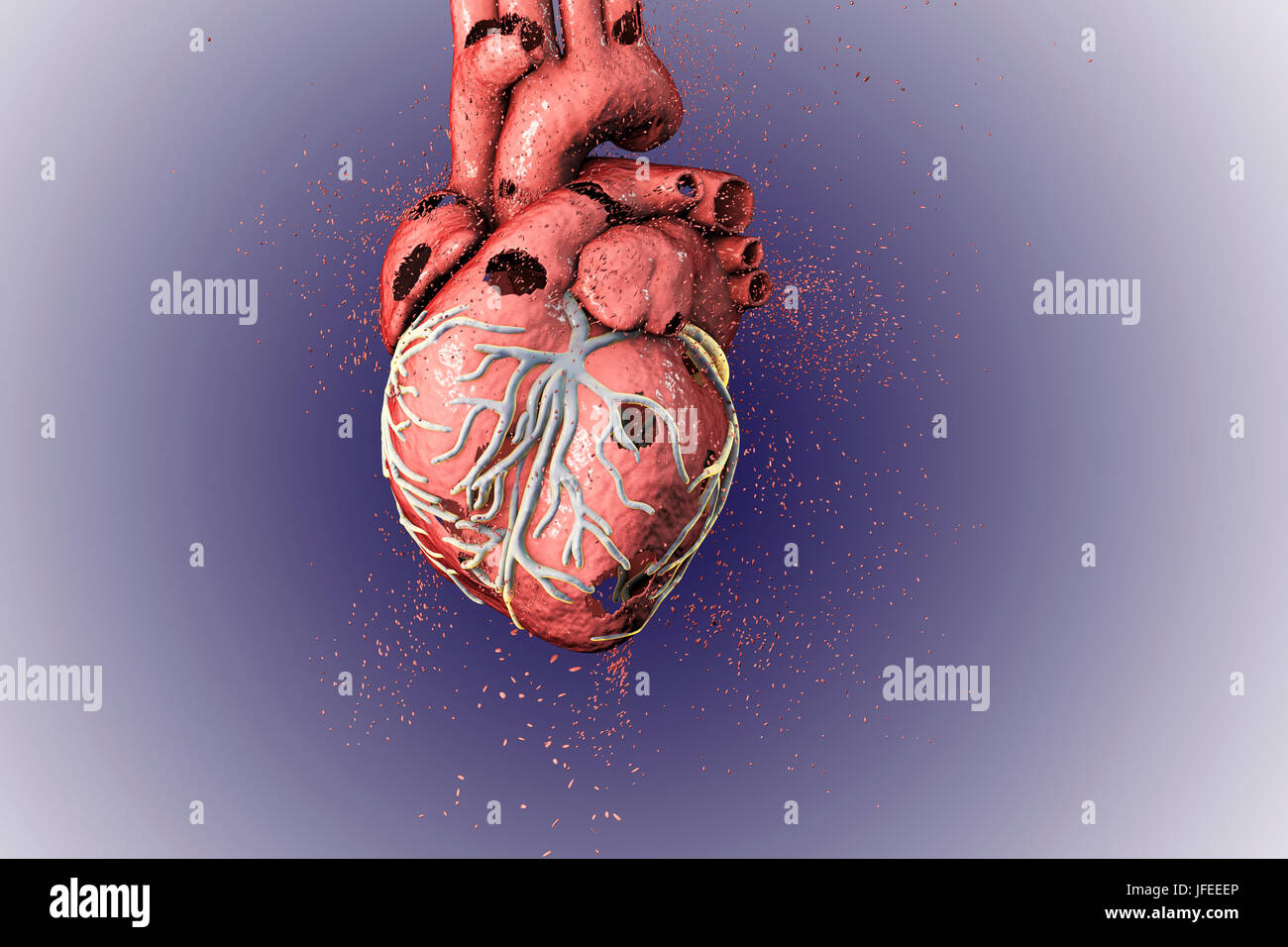 Cuore di distruzione. Concettuale illustrazione di computer che possono essere utilizzati per illustrare le malattie di cuore. Foto Stock