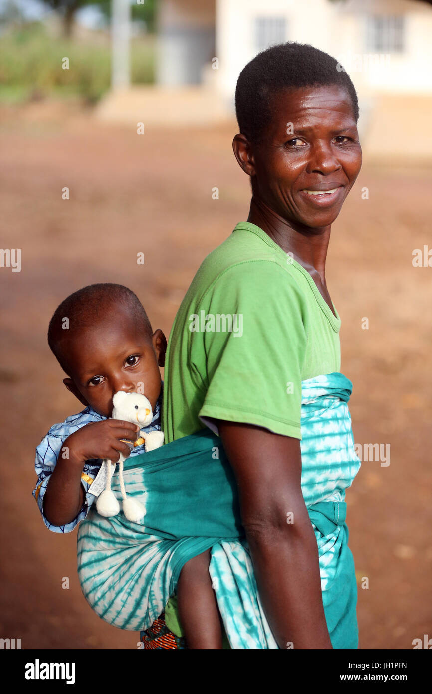 Ong francese : La Chaine de l'Espoir. Medicina Umanitaria. Il Togo. Foto Stock