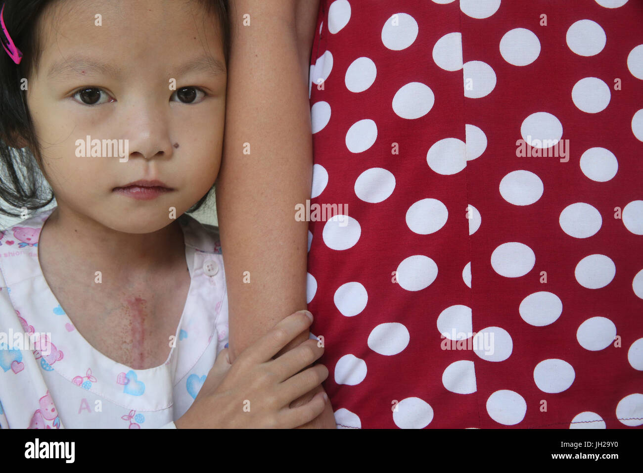 Il Heart Institute offrono elevata qualità della cura di vietnamita di pazienti affetti da malattie del cuore. La ragazza con la madre. Ho Chi Minh City. Il Vietnam. Foto Stock