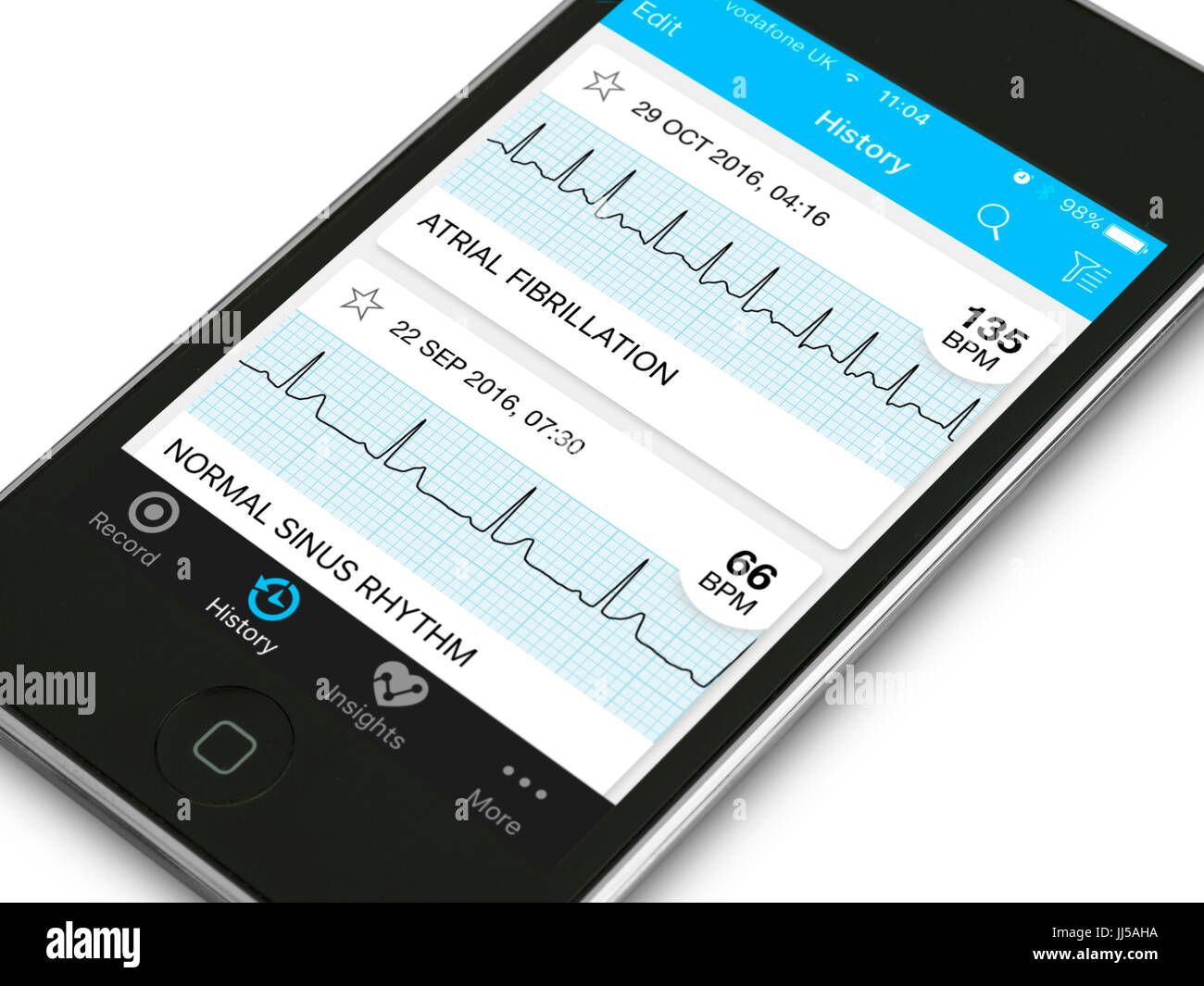 Mobile Salute e fitness app mostra vero cuore TRACCE ECG per la fibrillazione atriale aritmie e il ritmo sinusale normale su un dispositivo Apple. Foto Stock