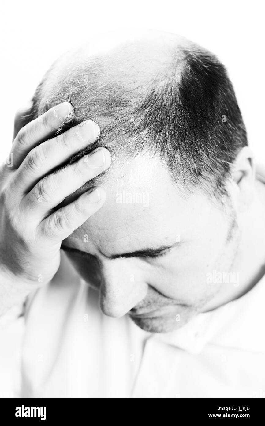 Uomo di mezza età interessate dalla perdita di capelli bald calvizie alopecia in bianco e nero Foto Stock