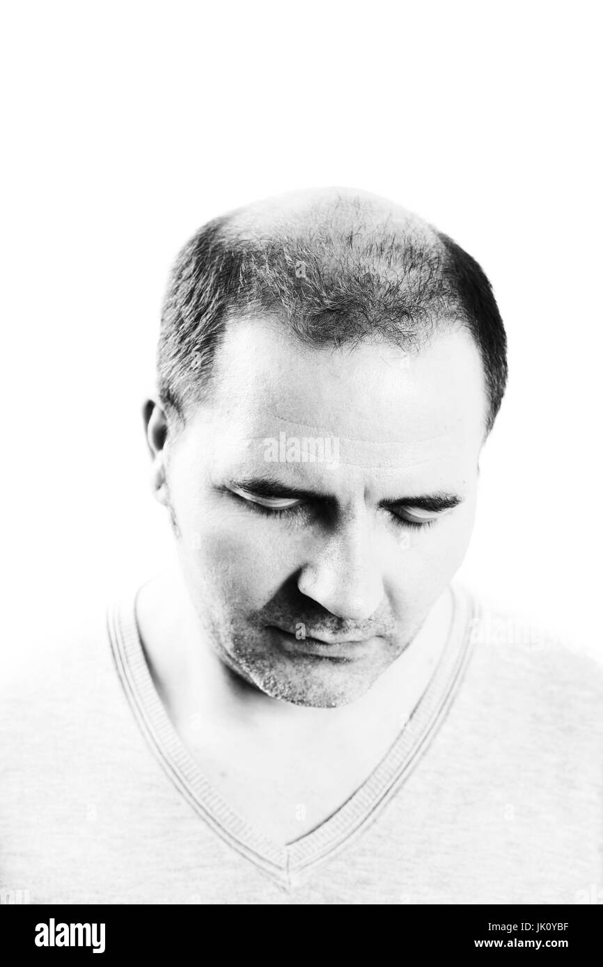 Uomo di mezza età interessate dalla perdita di capelli bald calvizie alopecia in bianco e nero Foto Stock