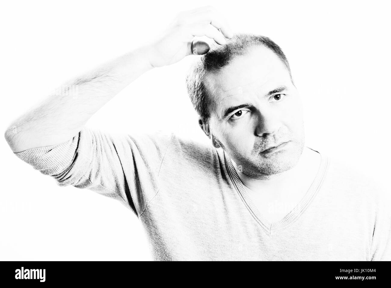 Uomo di mezza età interessate dalla perdita di capelli bald calvizie alopecia in bianco e nero Foto Stock