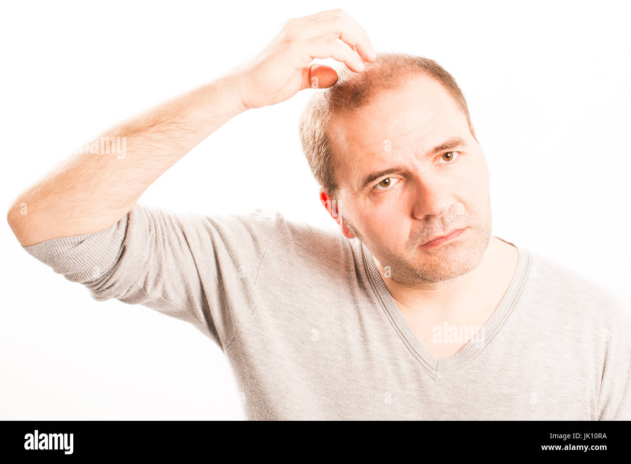Uomo di mezza età interessate dalla perdita di capelli bald calvizie alopecia in bianco e nero Foto Stock