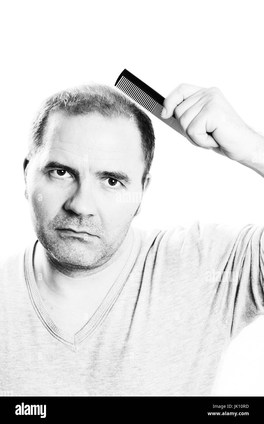 Uomo di mezza età interessate dalla perdita di capelli bald calvizie alopecia in bianco e nero Foto Stock