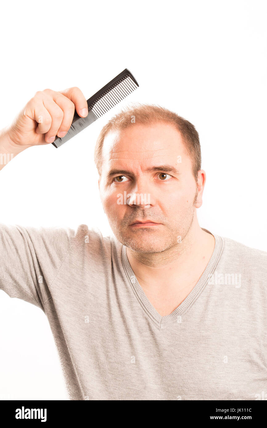 Uomo di mezza età interessate dalla perdita di capelli bald calvizie alopecia in bianco e nero Foto Stock