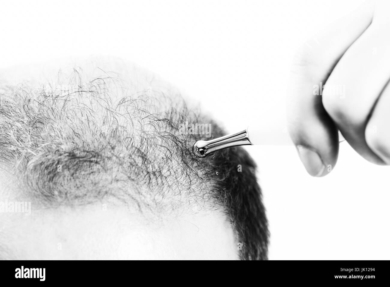 Uomo di mezza età interessate dalla perdita di capelli bald calvizie alopecia in bianco e nero Foto Stock