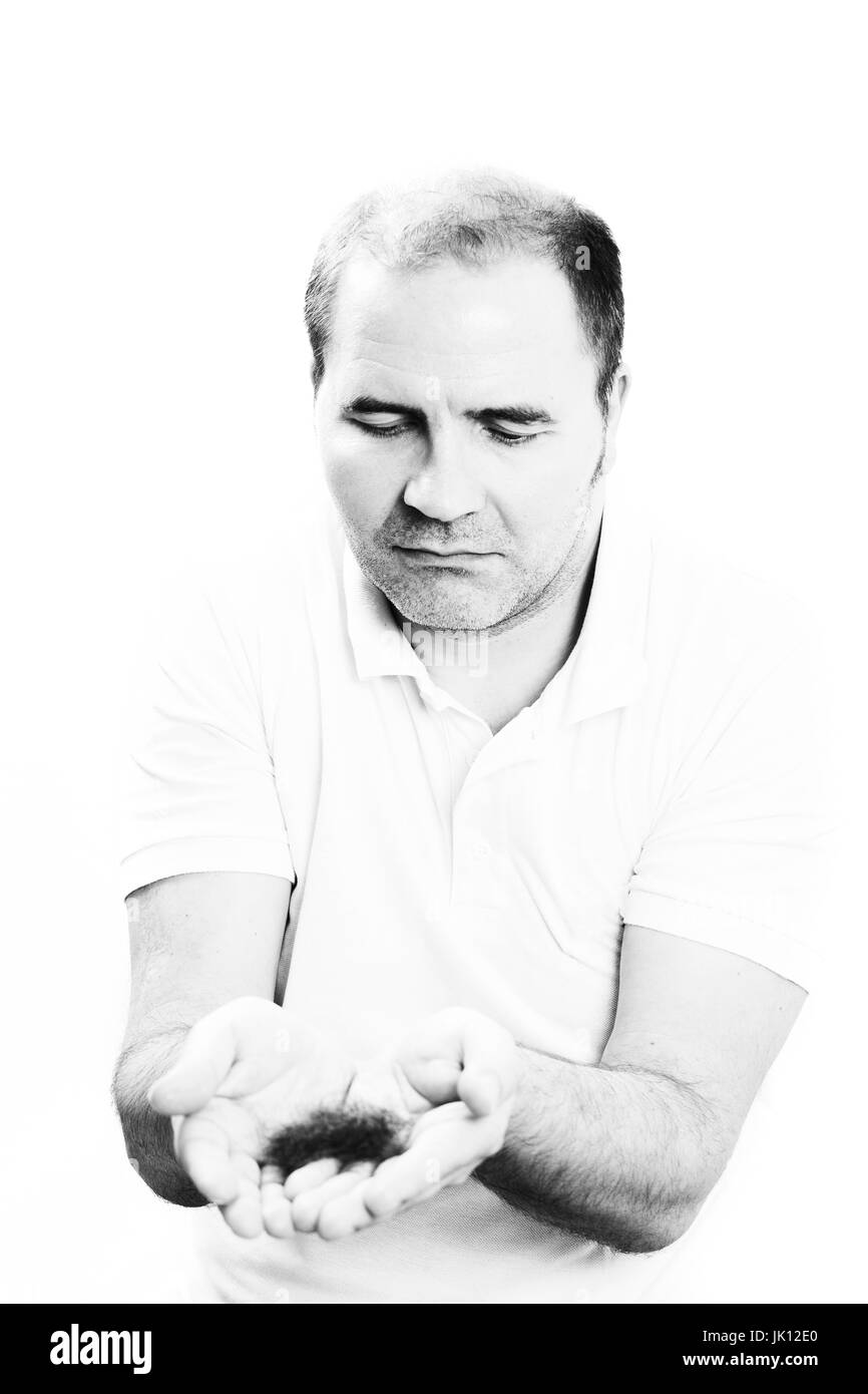 Uomo di mezza età interessate dalla perdita di capelli bald calvizie alopecia in bianco e nero Foto Stock