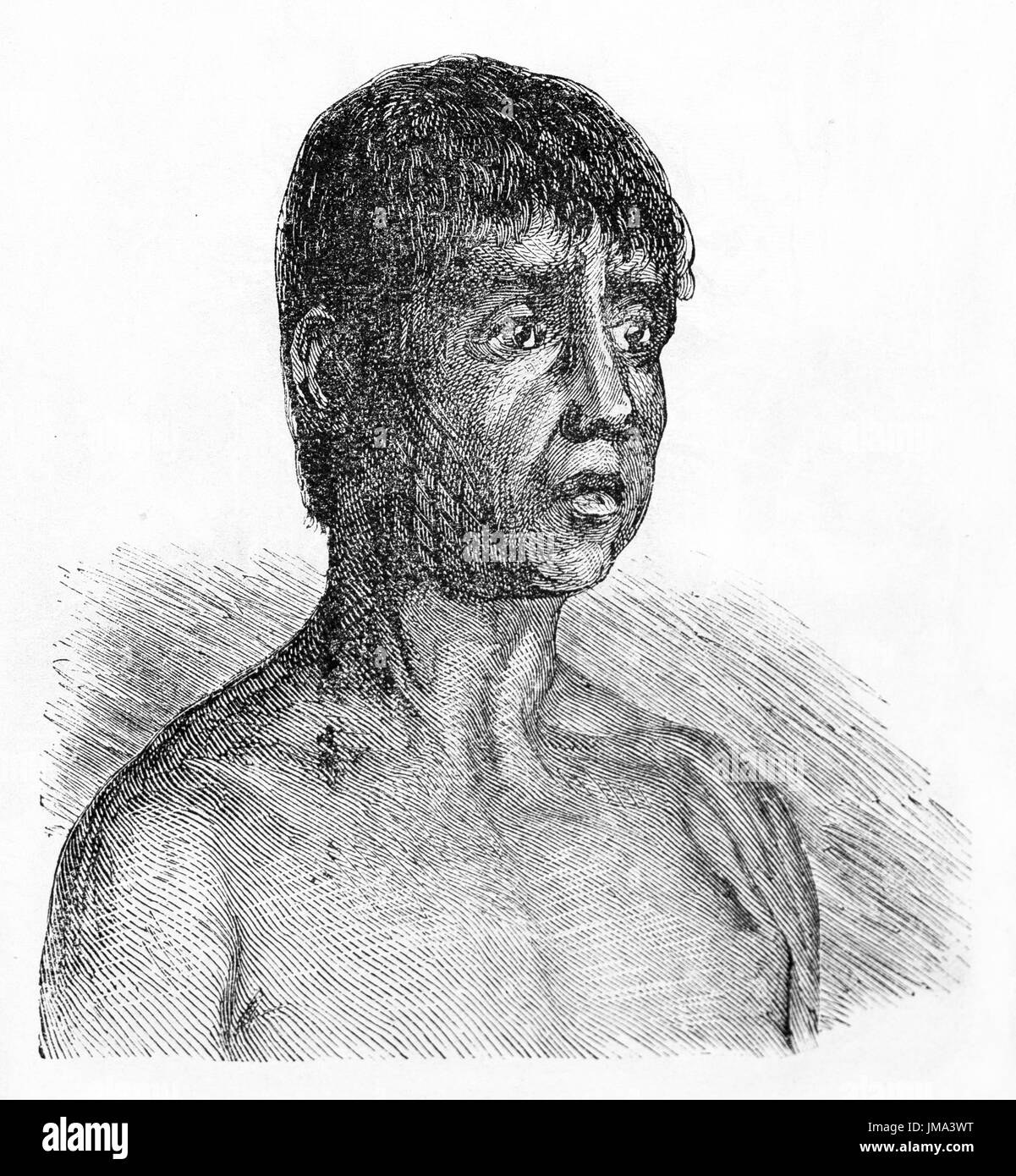 Primo piano ritratto di Maoes impaurito uomo che guarda a destra, Amazzonia regione, Brasile. Antica incisione d'arte di Riou e laly, le Tour du Monde, 1861 Foto Stock