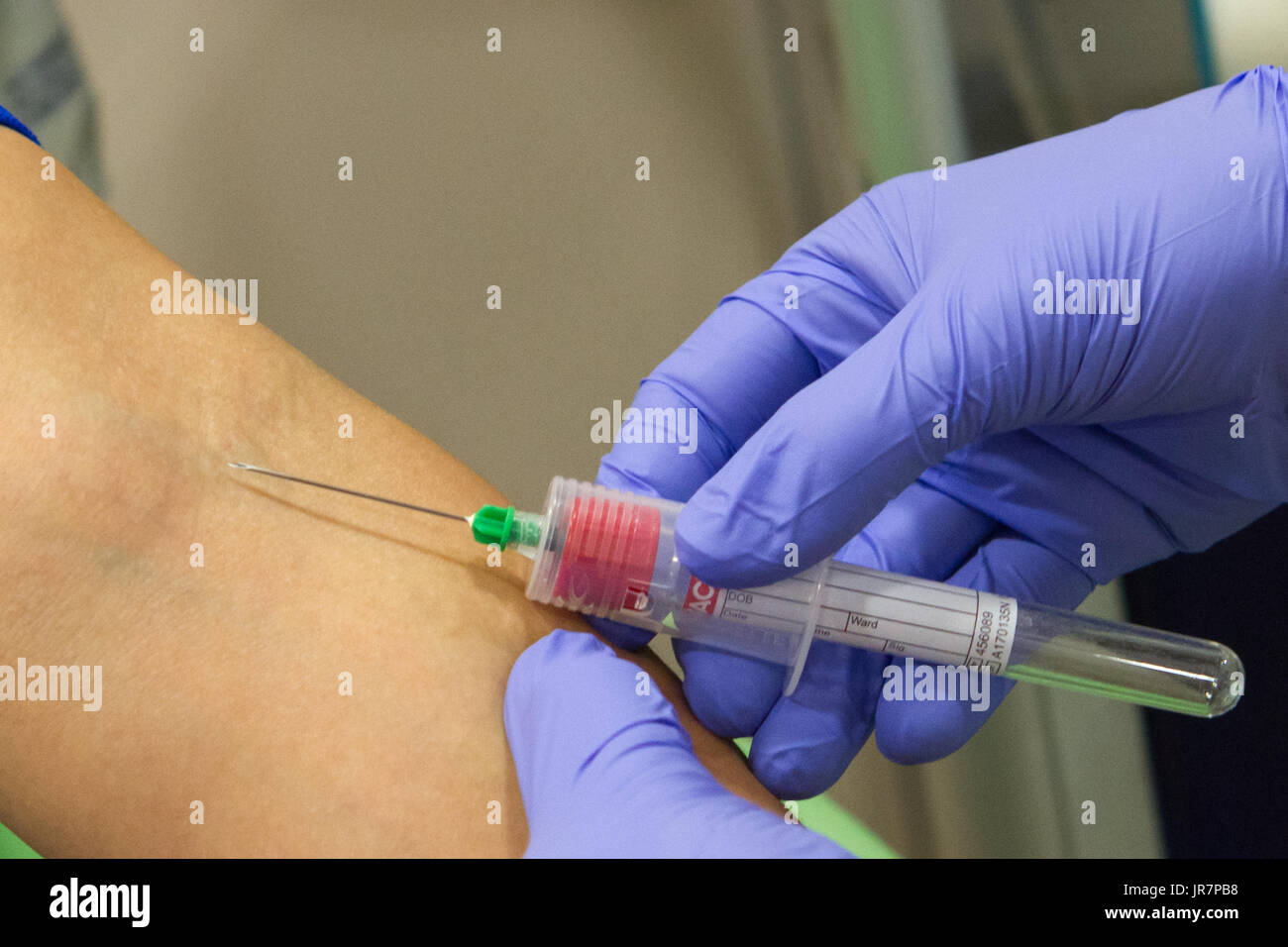 Zagabria, Croazia - Giugno 14, 2017: mani del medico donna prendendo campioni di sangue con l'ago dal paziente per il controllo annuale, foto concettuale della medicina Foto Stock