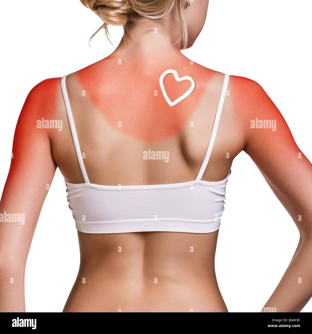 Protezione solare sulla spalla femminile. Foto Stock