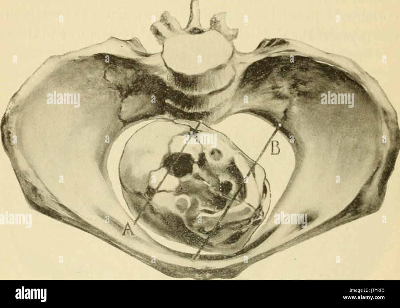 'Un Americano di libro di testo di ostetricia. Per professionisti e studenti" (1897) Foto Stock