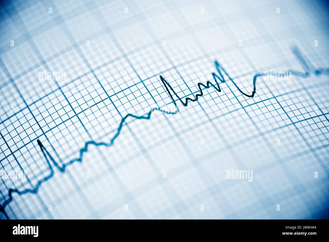 Close up di un elettrocardiogramma in forma cartacea. Foto Stock