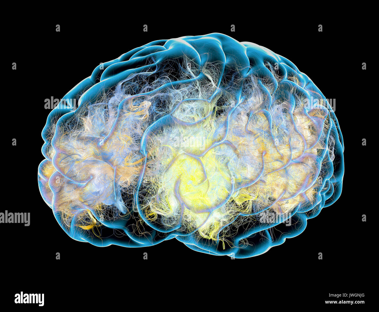 Cervello malattie degenerative, morbo di Parkinson, Sinapsi, neuroni, il morbo di Alzheimer, rendering 3D Foto Stock