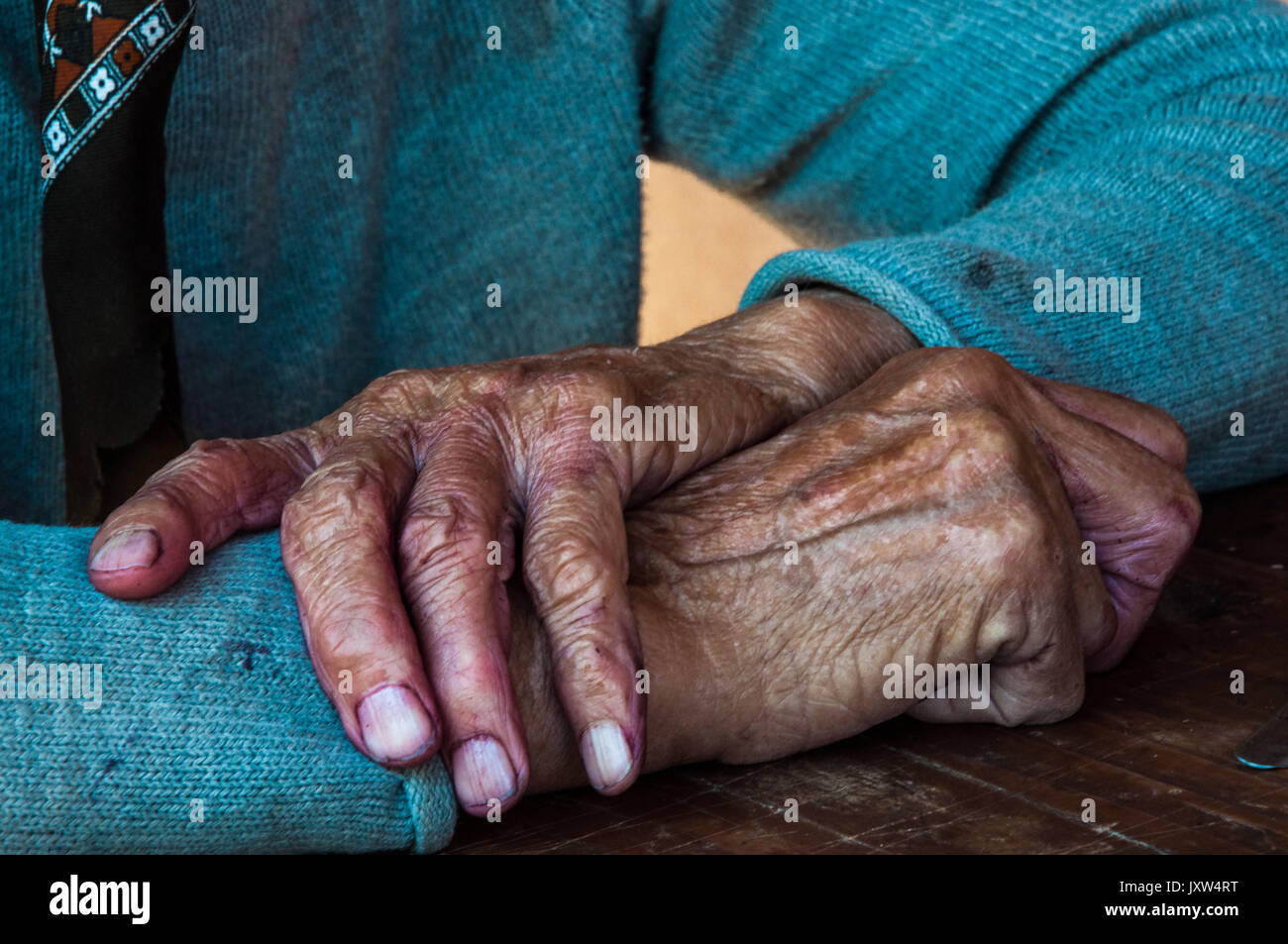 Le mani di una donna anziana, Vrbovac , Serbia Foto Stock