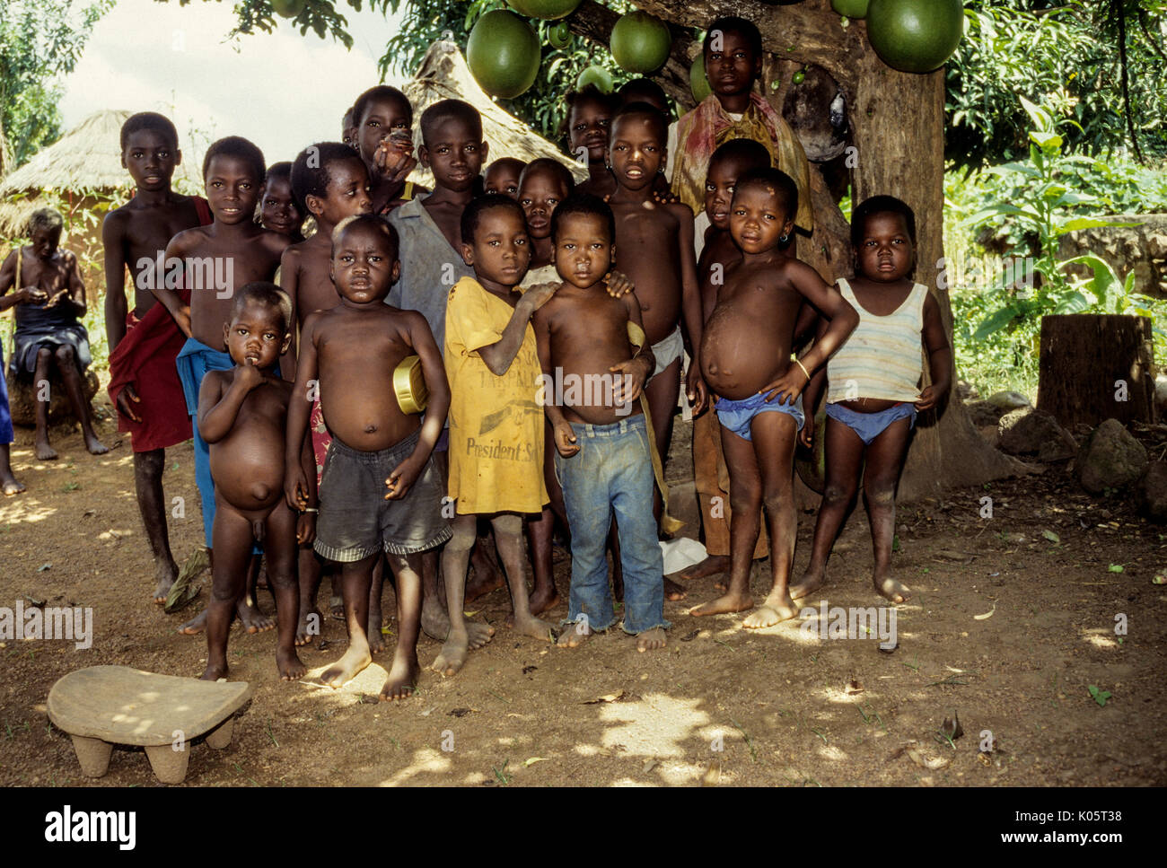 Costa d'Avorio, Costa d Avorio, Tabakala, Africa occidentale. Villaggio dei Ragazzi che mostra segni di malnutrizione, parassiti intestinali, possibile Kwashiorkor. Foto Stock