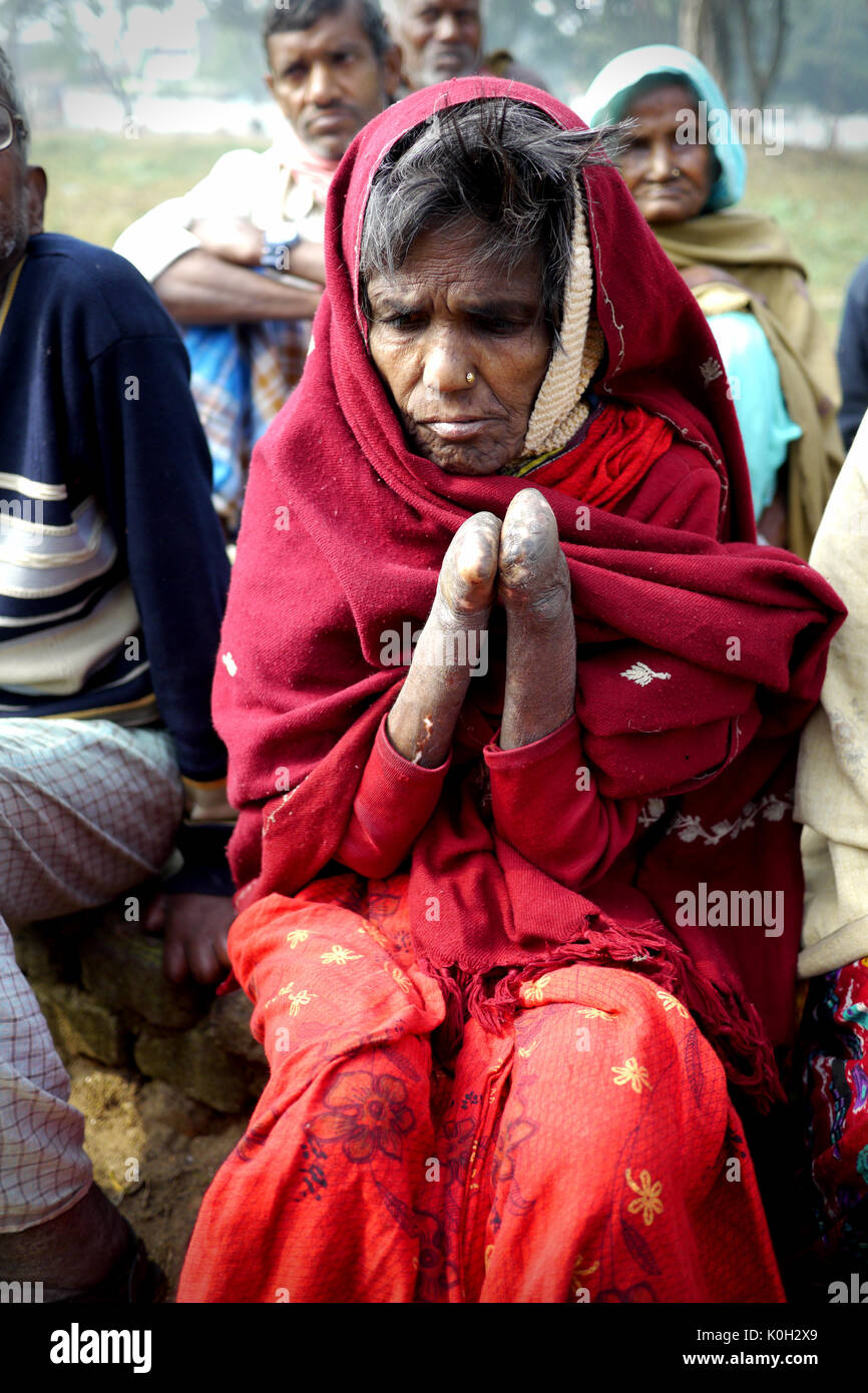 I lebbrosi in una colonia in India rurale Foto Stock