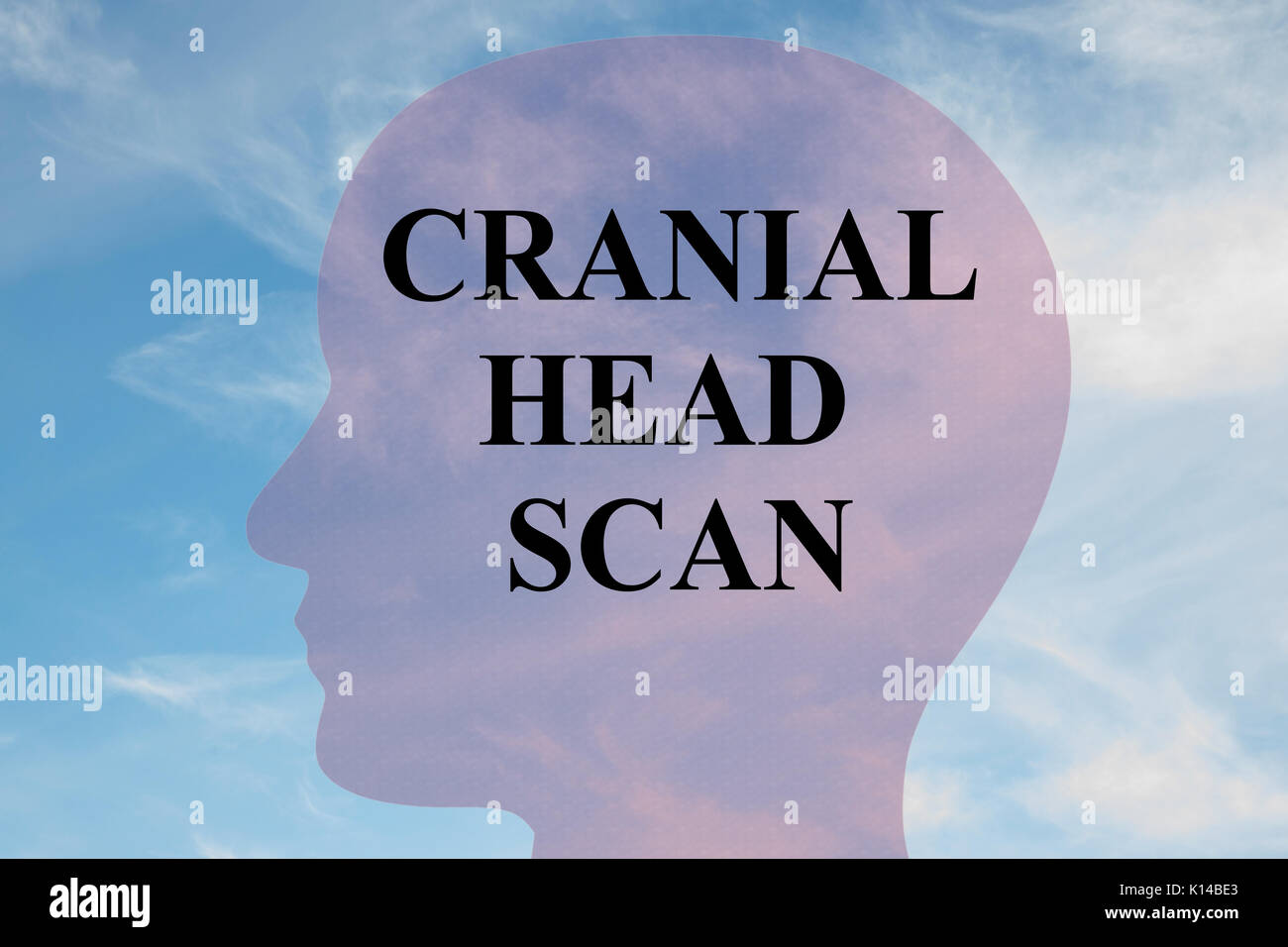 Il rendering di illustrazione di 'testa craniale SCAN" titolo sulla testa silhouette, con cielo nuvoloso come sfondo. Foto Stock