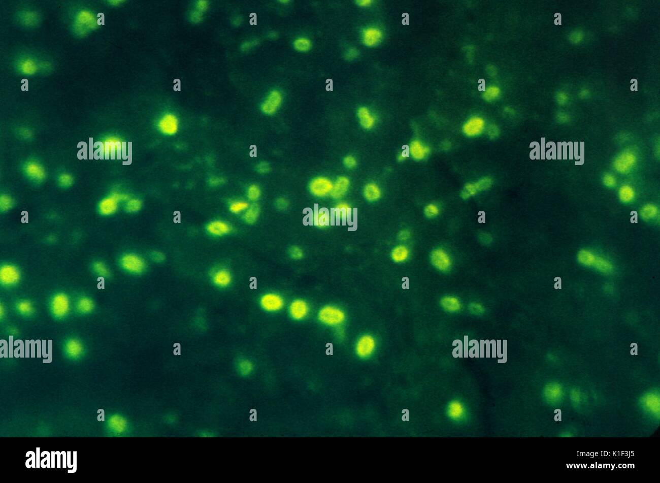 La fotomicrografia di Haemophilus influenzae mediante immunofluorescenza. La immunofluorescenza è una tecnica di colorazione utilizzato per rilevare e diagnosticare il H. influenzae batterio. Immagine cortesia CDC. 1990. Foto Stock