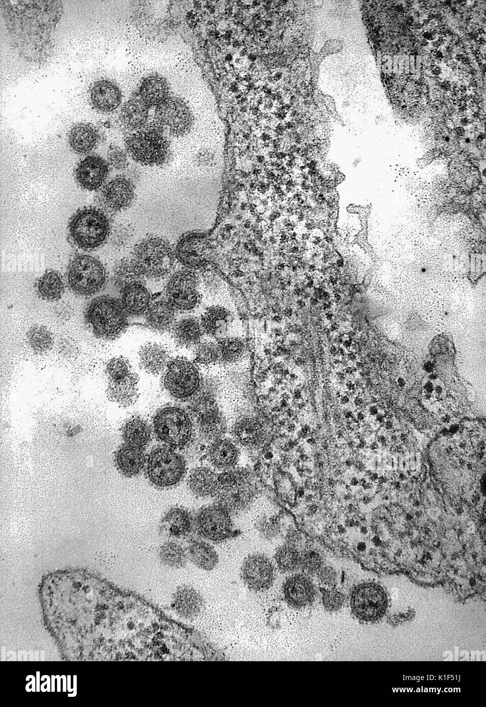 Electron microfotografia del Virus Machupo. Virus Machupo è un membro della famiglia Arenavirus, isolato in Beni Provincia di Bolivia in 1963, VIRALI Febbre emorragica. Immagine cortesia CDC/Dott. Fred Murphy, Sylvia Whitfield, 1975. Foto Stock