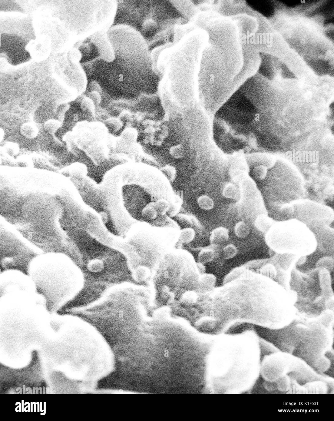 Micrografia elettronica a scansione di virus di immunodeficienza umana (HIV), cresciuto in linfociti coltivati. I virioni sono visti come piccole sfere sulla superficie delle cellule. Immagine cortesia CDC/Cynthia orafo, P. Feorino, E. L. Palmer, W. R. McManus, 1984. Foto Stock