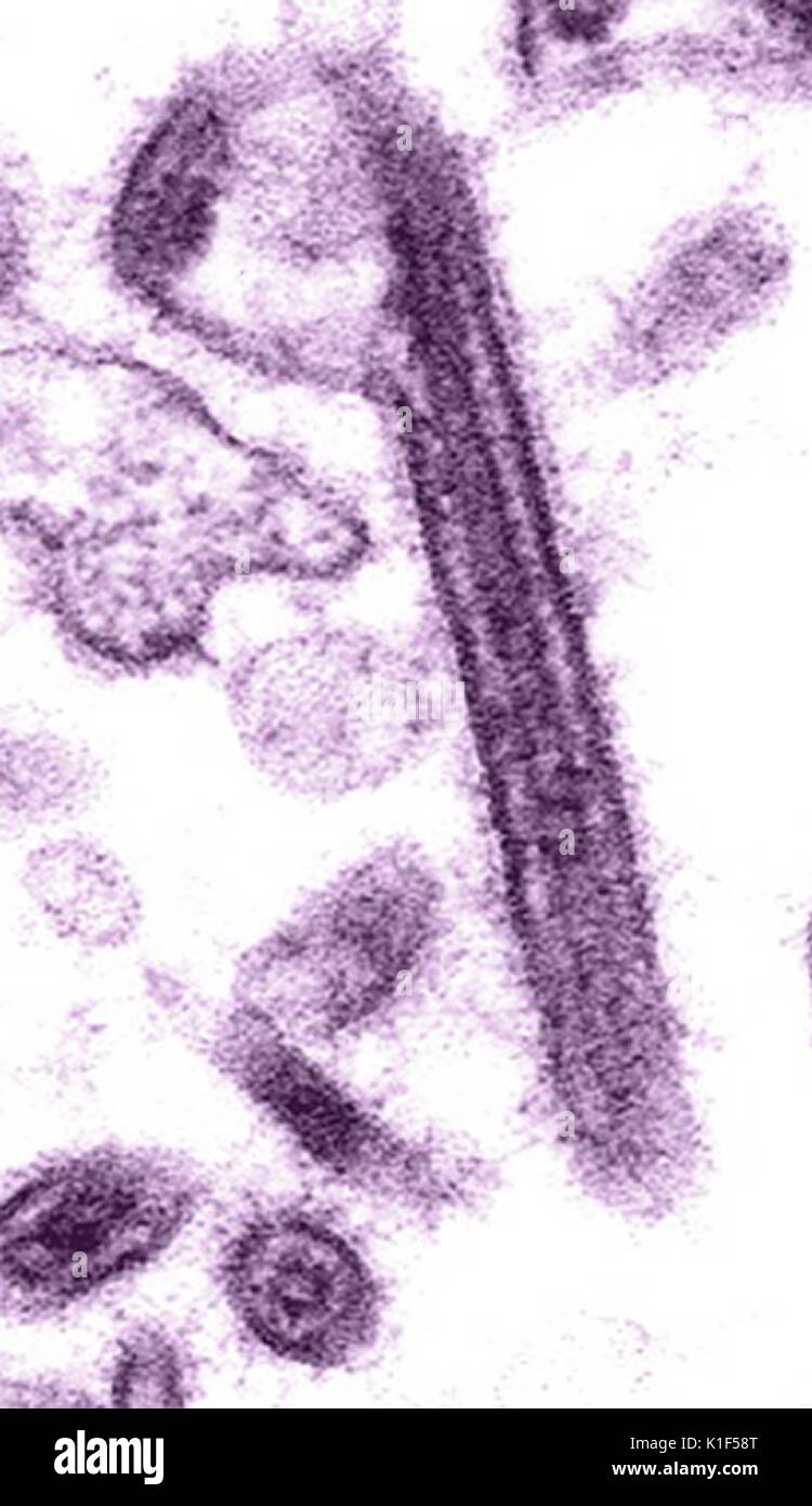 Colorizzato Micrografia elettronica a trasmissione del virus Ebola. La febbre emorragica, RNA virus. Immagine cortesia CDC/Cynthia Goldsmith. 1990. Foto Stock